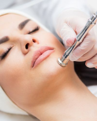 Microdermabrasion